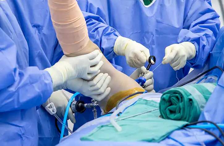 Shoulder Arthroscopy
