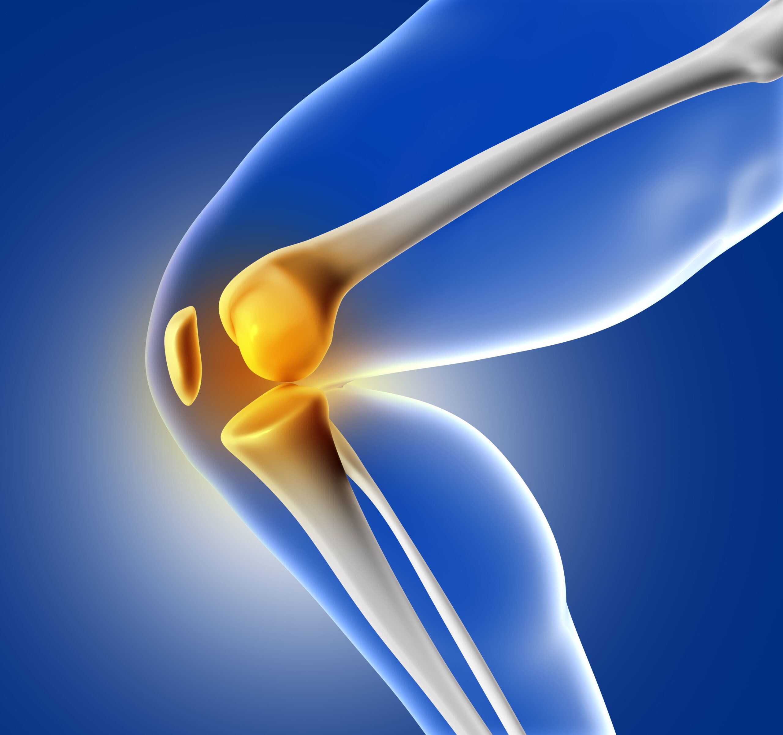 Total Knee Replacement in Bangalore: Costs, Recovery, and What to Expect