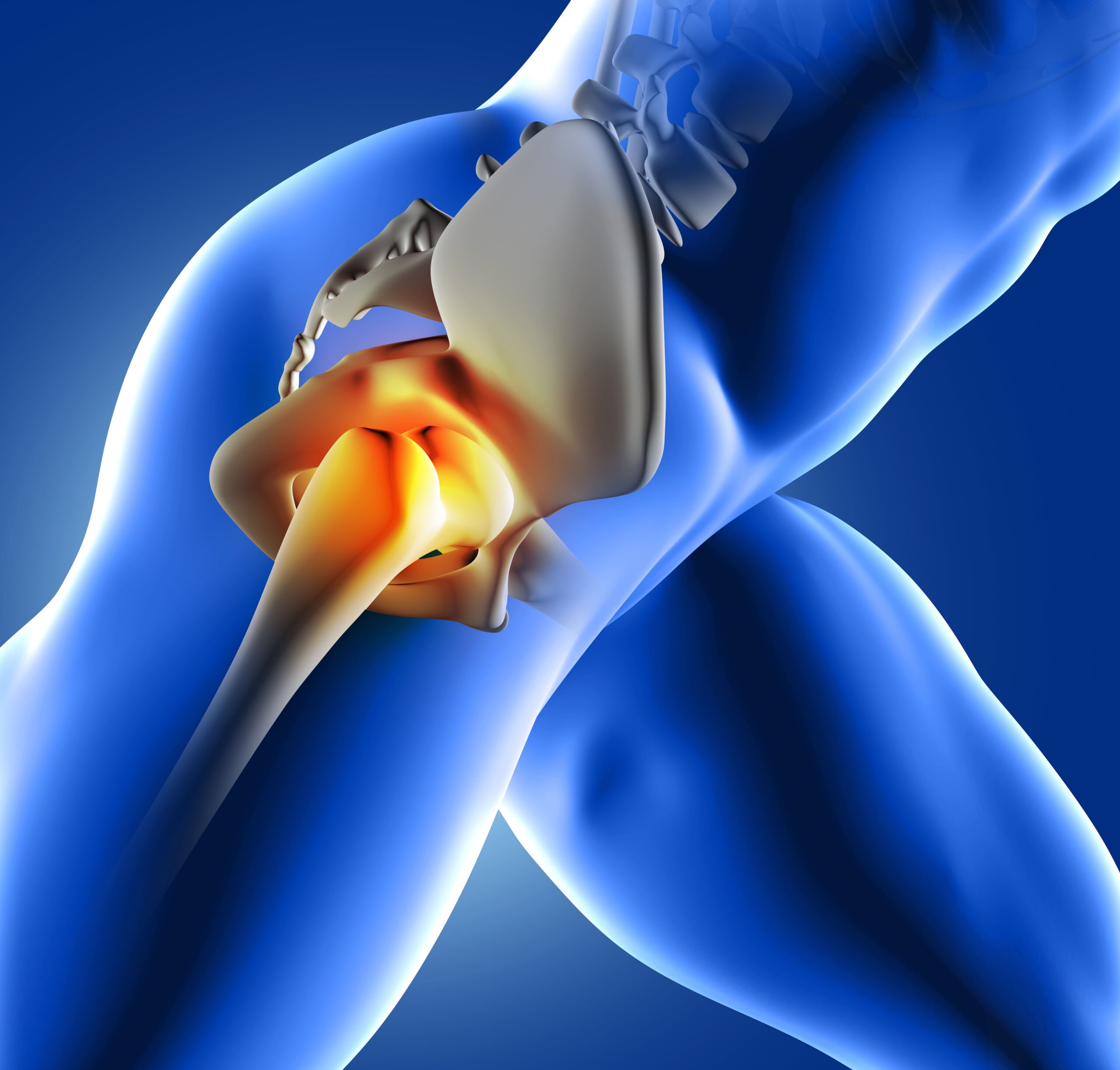 Hip Replacement Surgery: Recovery, Risks, and When It’s the Right Option