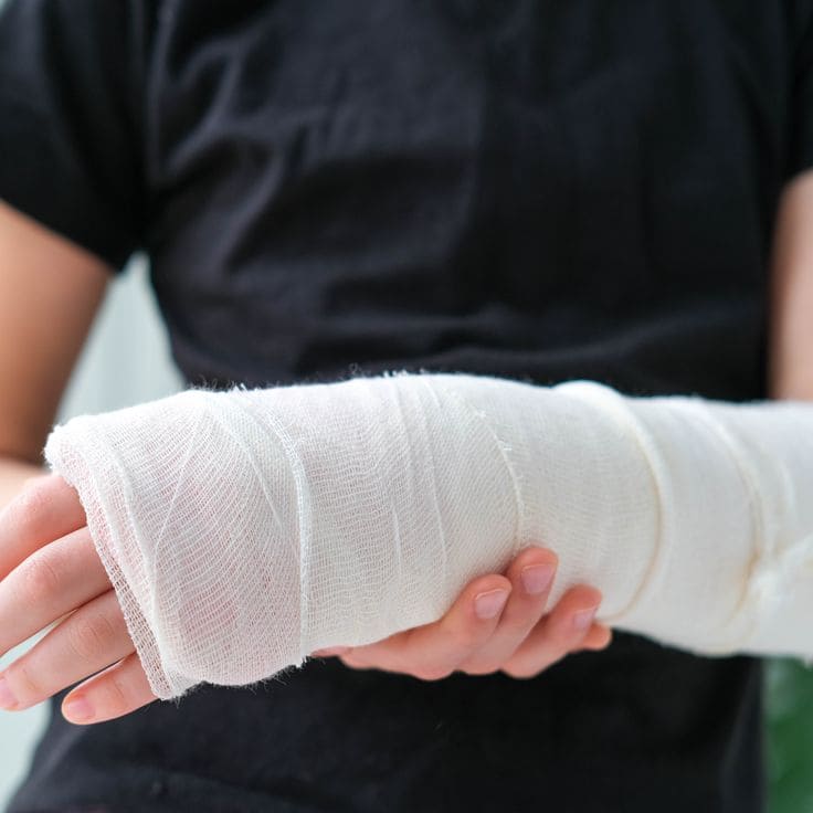 Fracture Care: Importance of Timely Orthopaedic Treatment